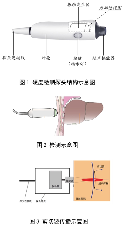定量剪切波超聲肝臟測量儀注冊審查指導(dǎo)原則(2023年第7號(hào))(圖2) 定量剪切波超聲肝臟測量儀注冊審查指導(dǎo)原則(2023年第7號(hào))(圖2)