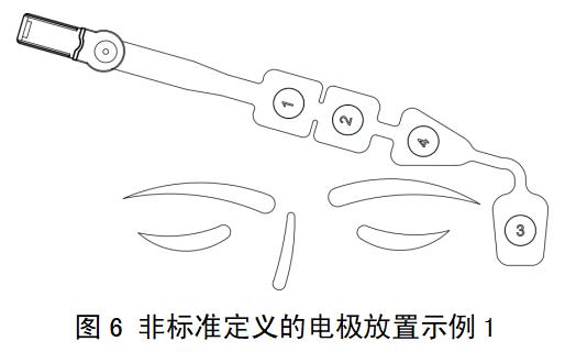 一次性使用腦電電極注冊(cè)審查指導(dǎo)原則(2022年第35號(hào))(圖5) 一次性使用腦電電極注冊(cè)審查指導(dǎo)原則(2022年第35號(hào))(圖5)