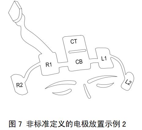 一次性使用腦電電極注冊(cè)審查指導(dǎo)原則(2022年第35號(hào))(圖6) 一次性使用腦電電極注冊(cè)審查指導(dǎo)原則(2022年第35號(hào))(圖6)